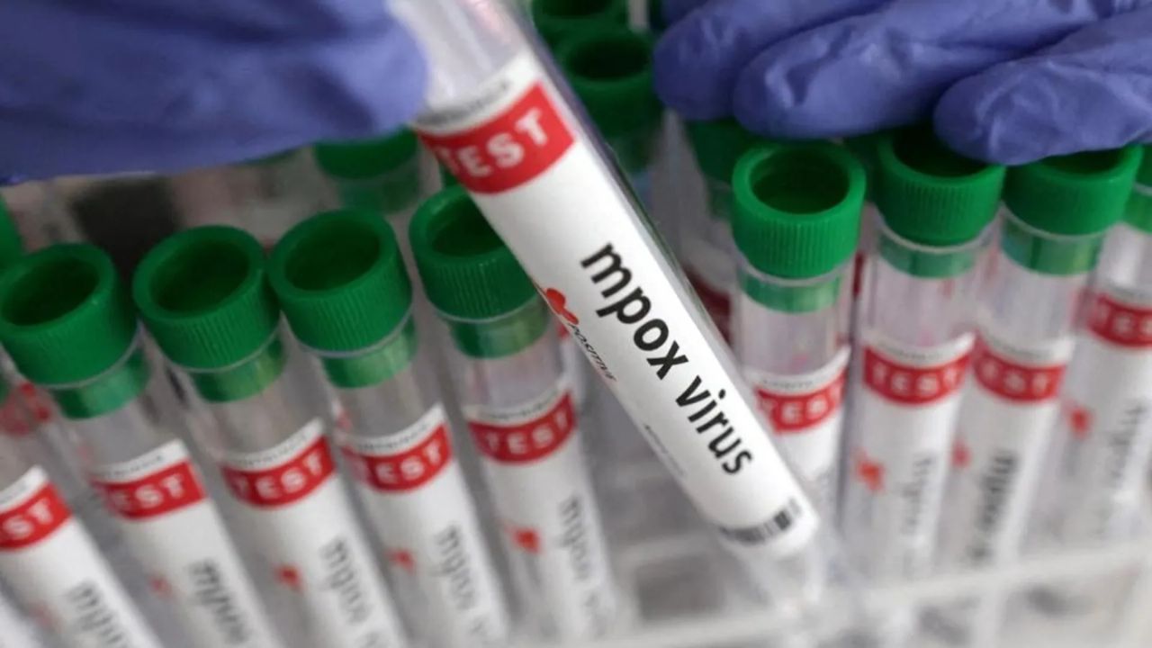 India’s First Suspected Mpox Case: Man Isolated After Returning from Abroad
