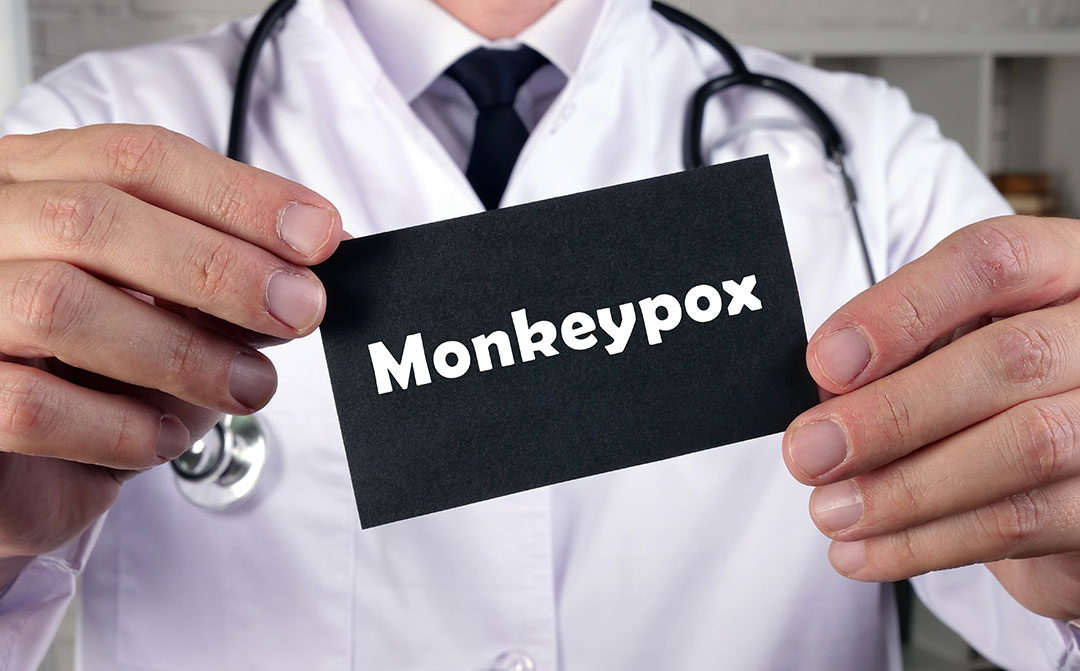 Amidst receiving two cases of monkeypox, the center directed for strict screening at the airport-ports