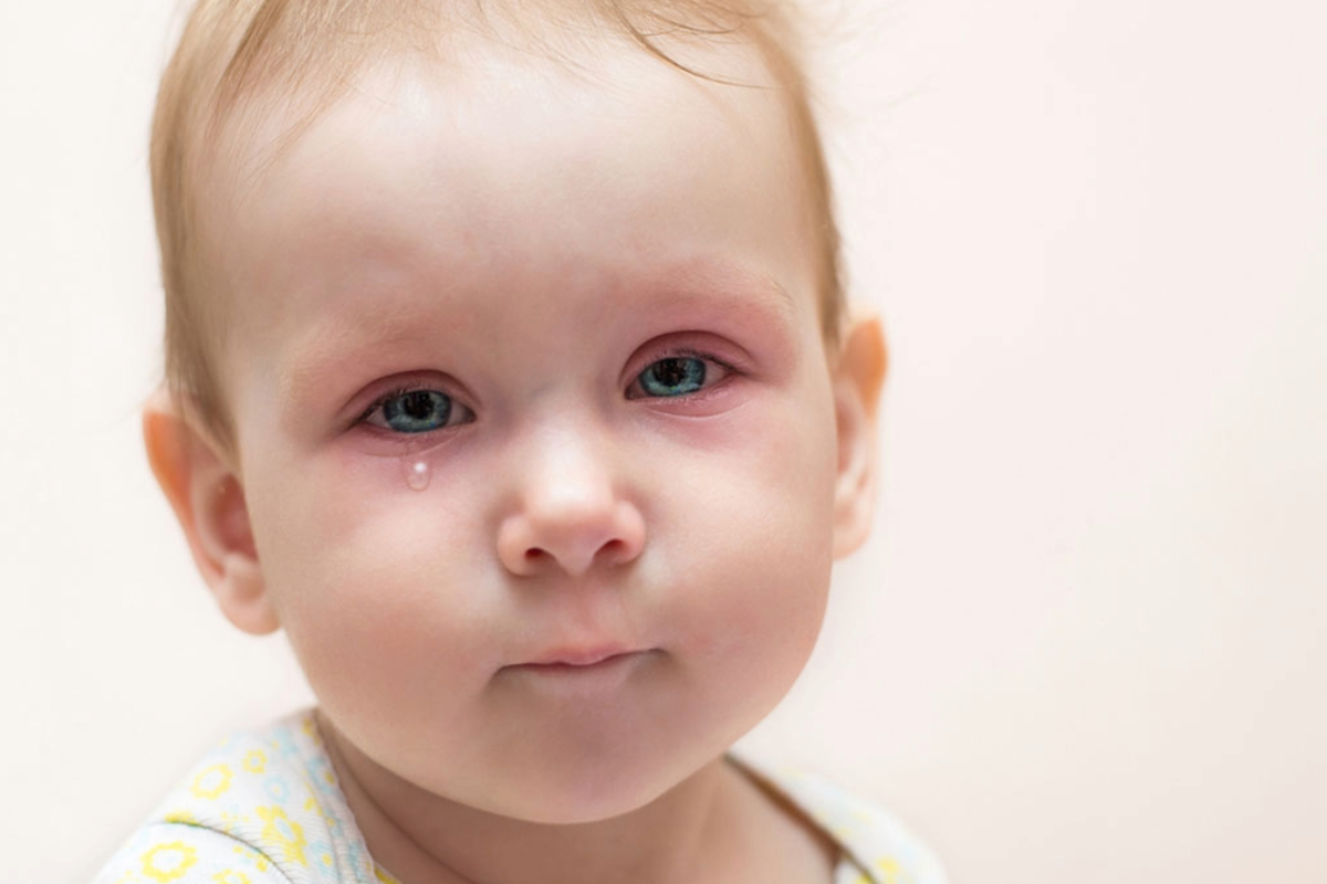 Watery Eyes in Babies: Causes from Common Cold to Conjunctivitis Explained