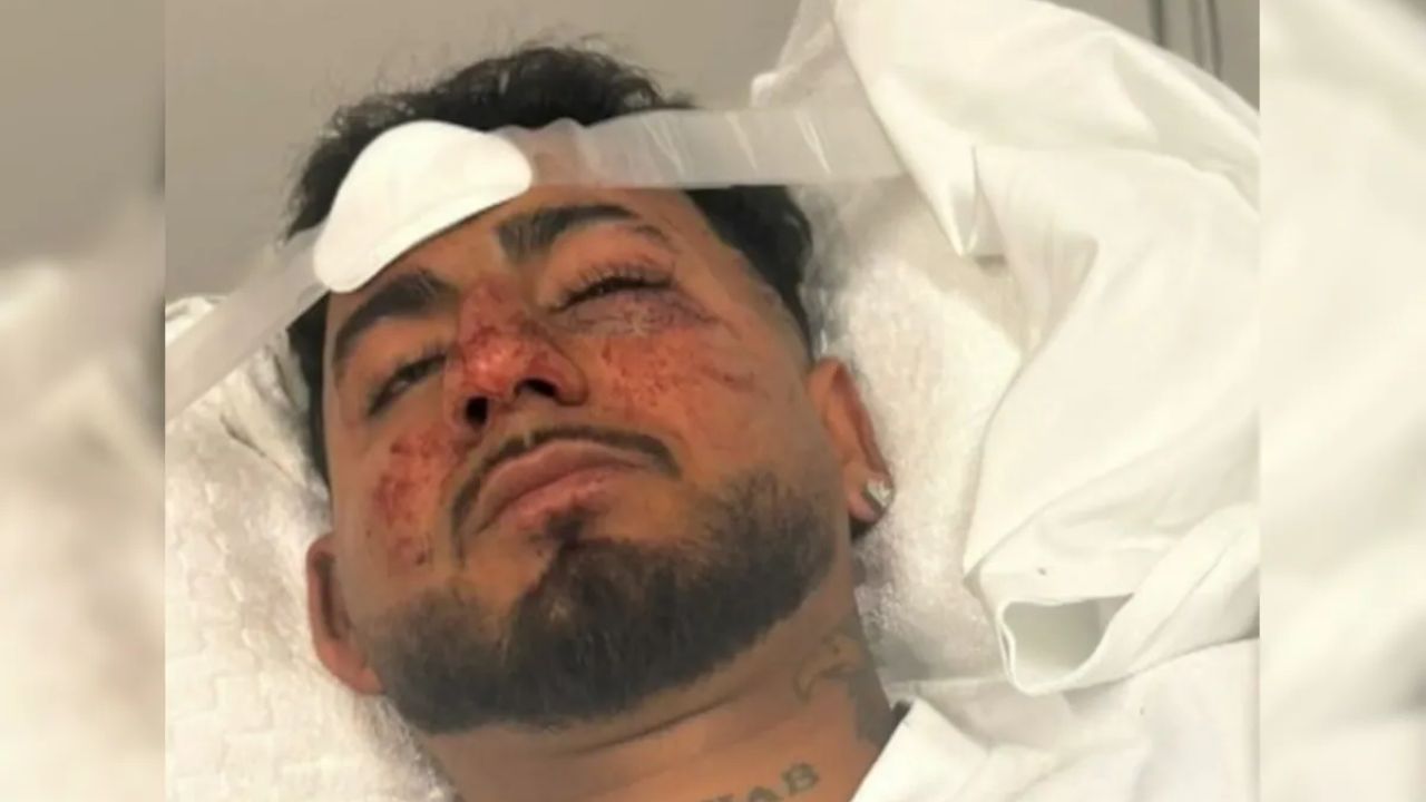 23-Year-Old Indian Student Brutally Assaulted in Adelaide, Sustains Brain Trauma and Facial Fracture