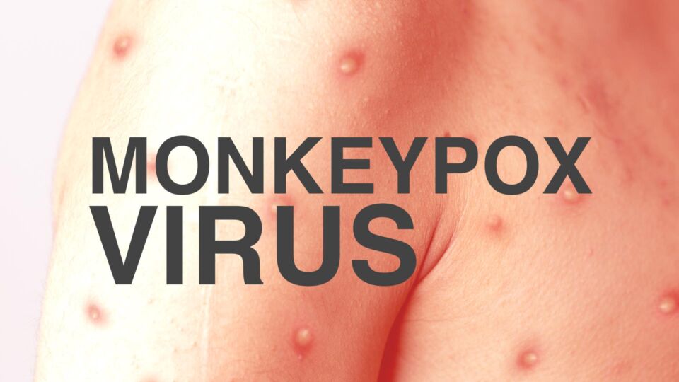 Monkeypox Virus in India: 9th case of monkeypox in Delhi, number of cases in the country increased to 14