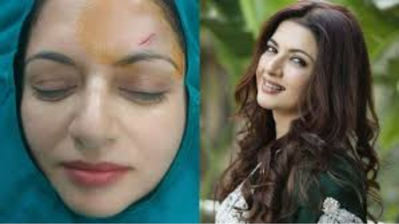 Bhagyashree Injured While Playing Pickleball, Gets 13 Stitches on Forehead