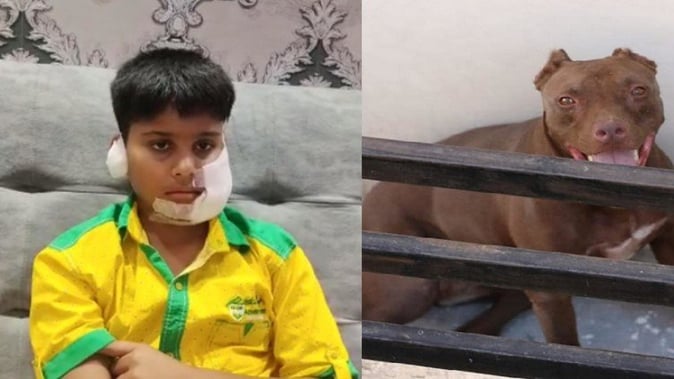Ghaziabad: Pitbull Dog Bites A Kid Violently, Undergoes Surgery And Over 150 Stitches, Cries with Pain