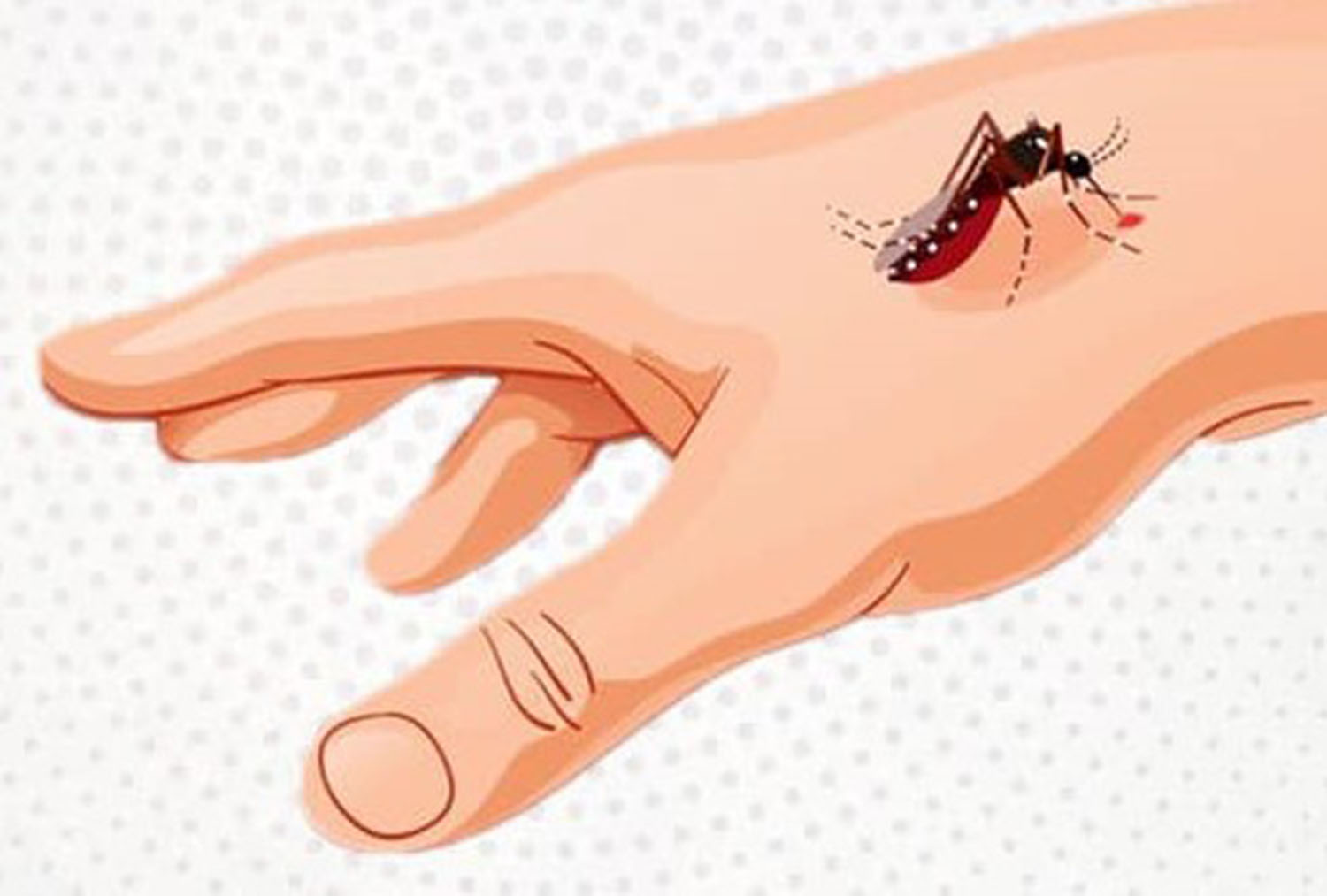 Take Early Preventive Measures to Combat Dengue during Monsoon